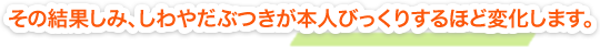 その結果しみ、しわやだぶつきが本人びっくりするほど変化します。